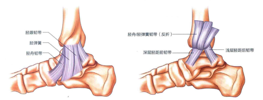 盘点急性踝关节扭伤5大处理原则,你会选择谁?