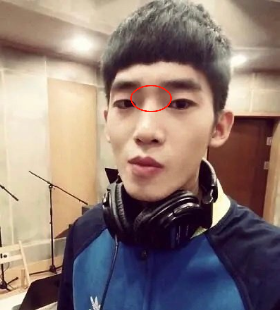 于适旧照被扒疑整容,山根拔地而起鼻头圆润,和如今模样判若两人