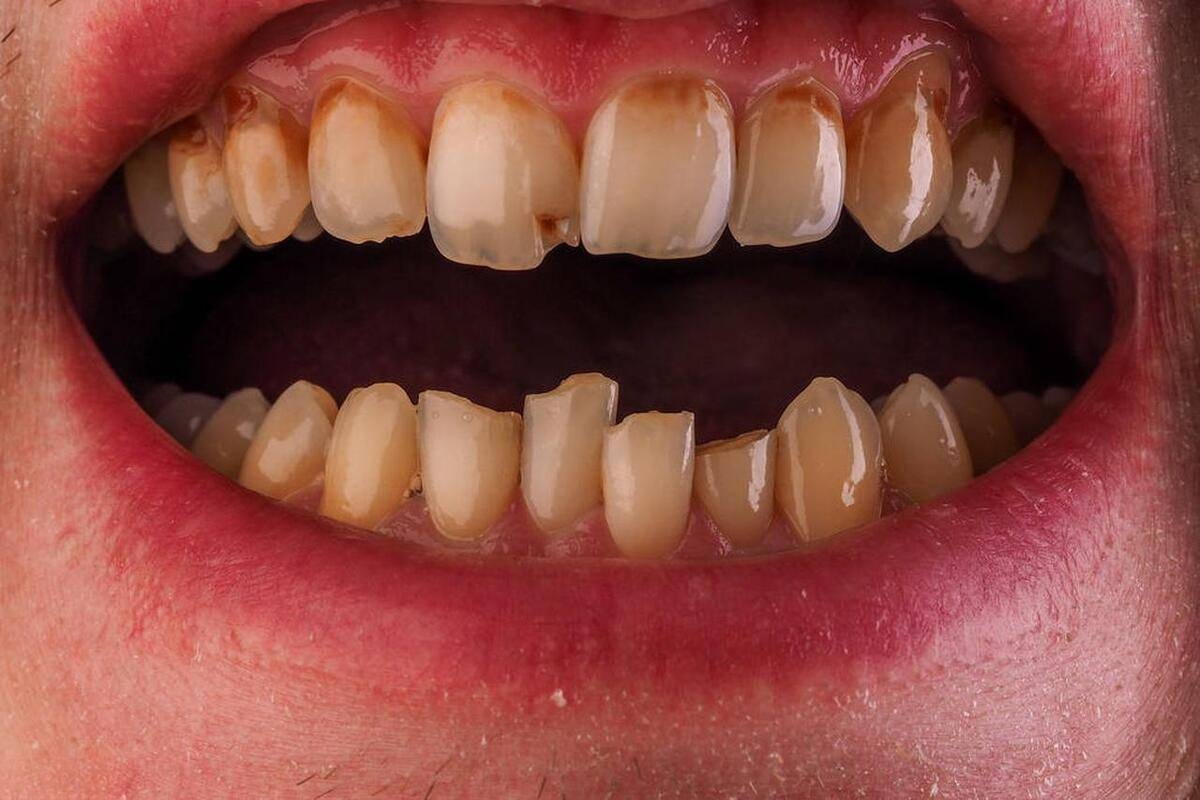 牙齿两颗大门牙上，是长了个东西吗，有点疼，怎么办_口腔科_邻医网