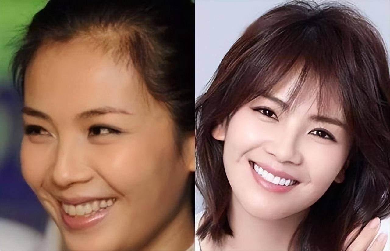 45岁刘涛被质疑整容,网友表示认不出,像换了一张脸越活越年轻