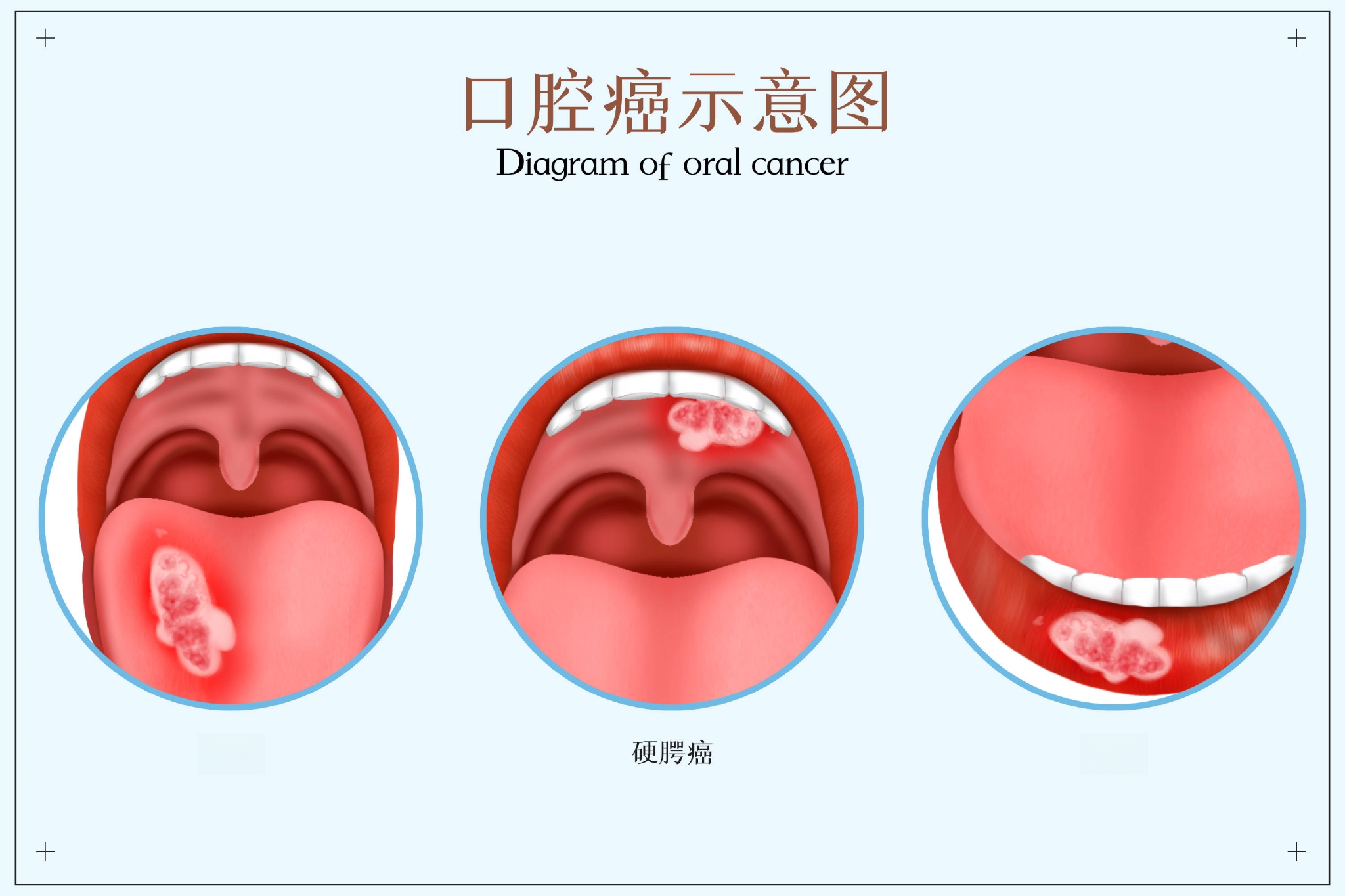 同济口腔怎么挂号(同济口腔挂号当天能看上吗)