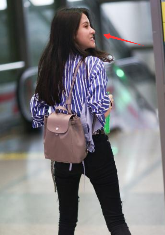 张碧晨被质疑整容,素颜与化妆后判若两人,脸歪鼻孔太怪异