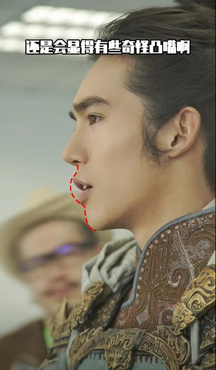 于适旧照被扒疑整容,山根拔地而起鼻头圆润,和如今模样判若两人