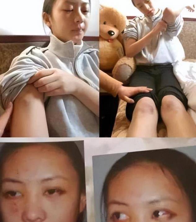 2003年年末,张默在中戏的女生宿舍门口暴力殴打童瑶,导致童瑶外表多处
