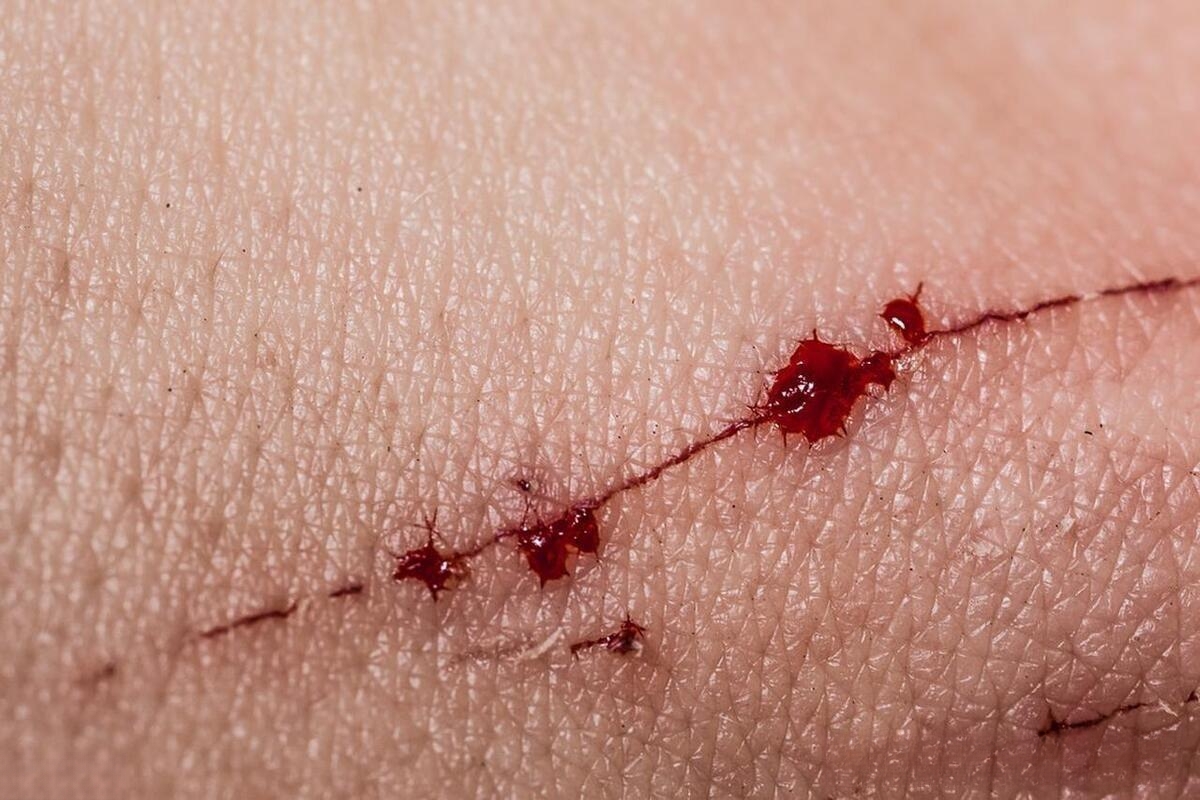 尽快去医院才是最佳选择